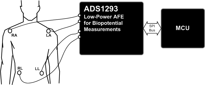 3lead_ecg_simplified.gif